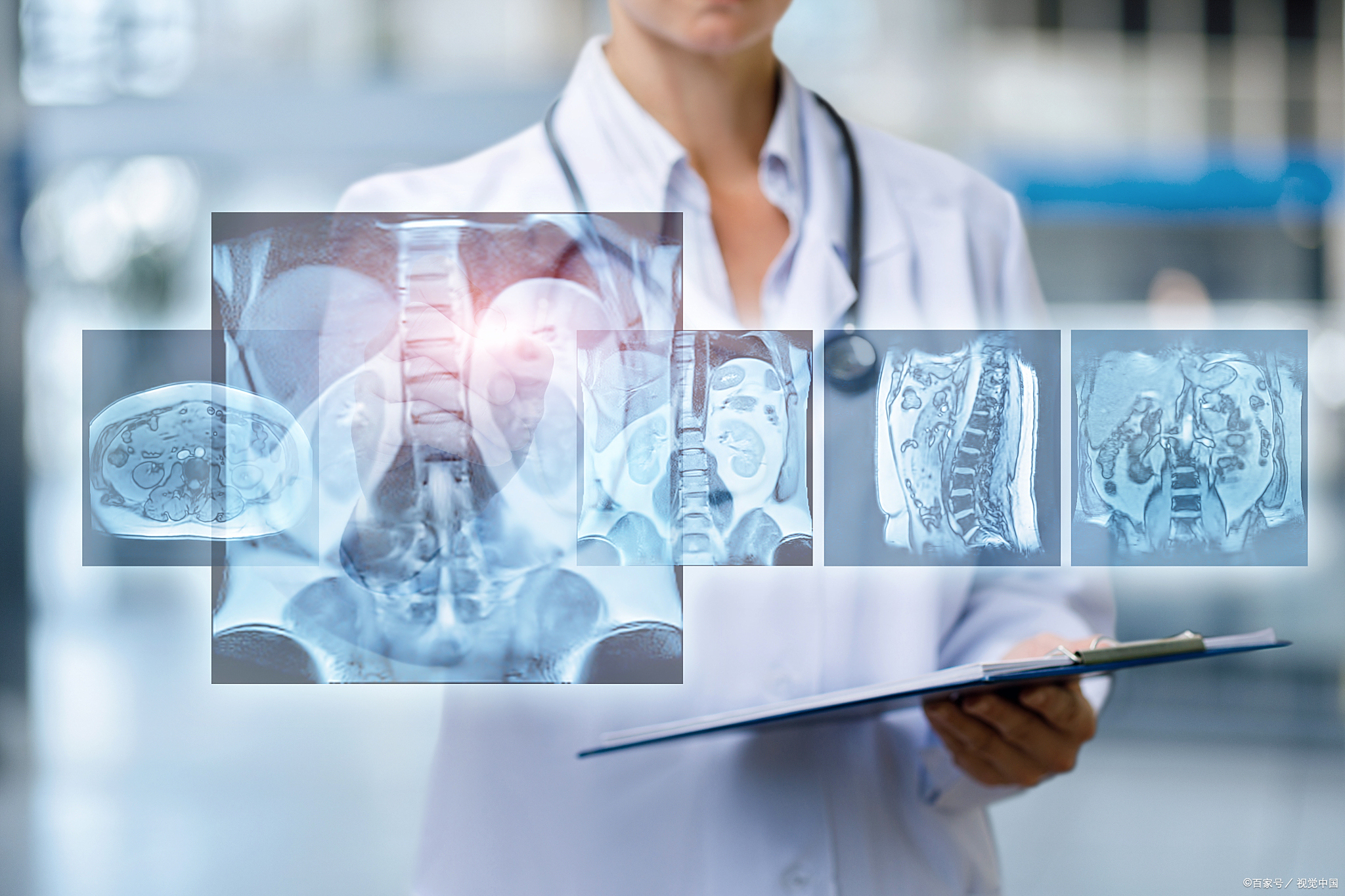 德适生物再战IPO：员工减少实控人套现6600万，行业智能辅助占比仅1%