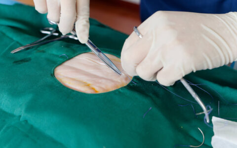 百迈科核心产品单价不断下行：预付款急剧大增，一年时间入股价暴增